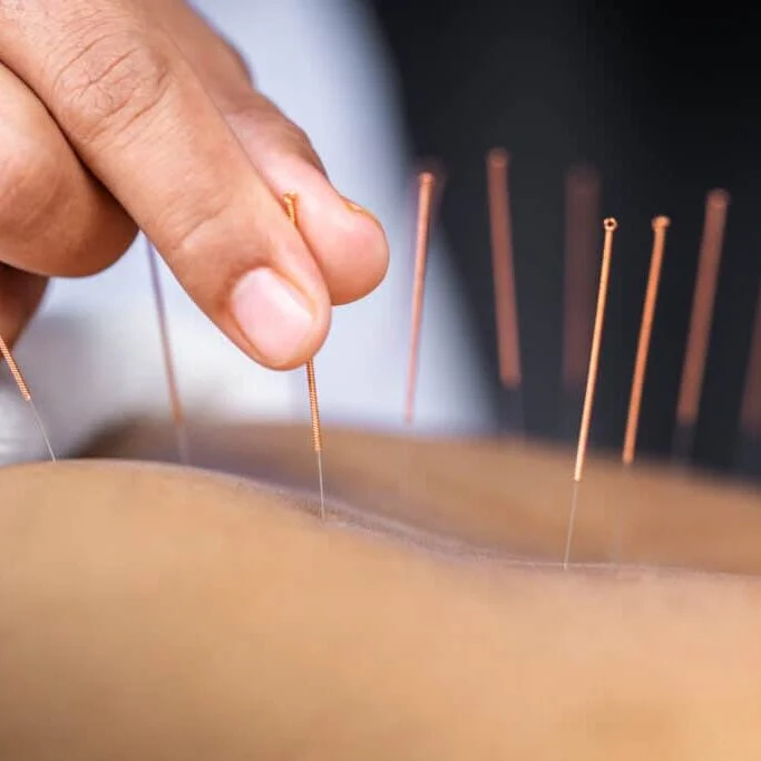 Wellpoint Acupuncture
